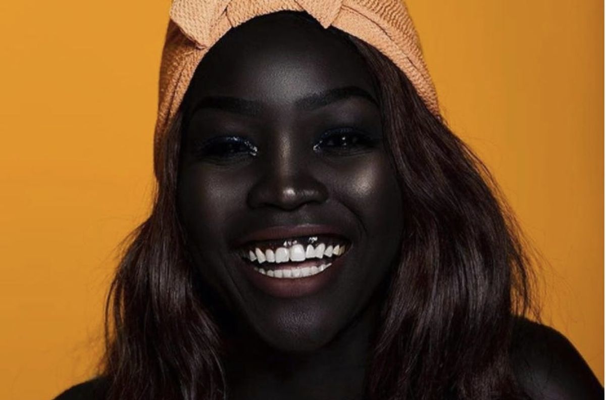 This Model’s Response to a Rude Question About Her Dark Skin Will Make ...