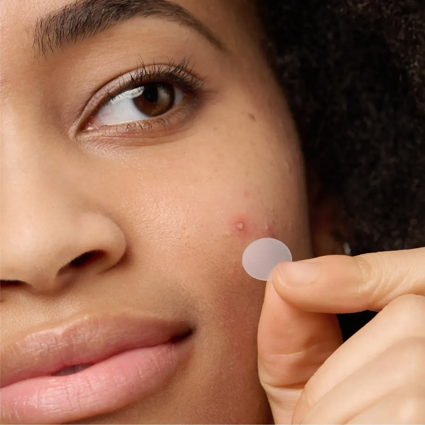 best pimple patches